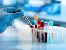 paraovarian cyst treatment in Noida 