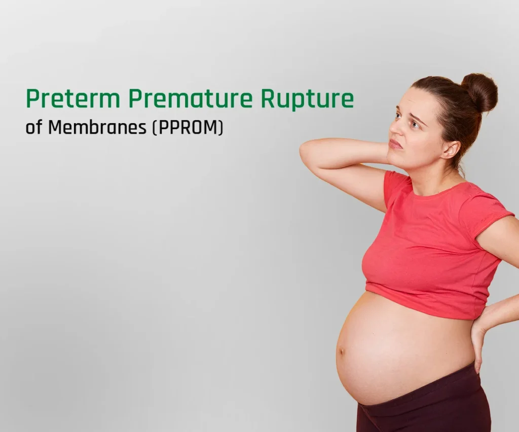 Preterm Pre-labour Rupture of Membranes (PPROM): Causes, Risks & Management Options Preterm Pre-labour Rupture of Membranes (PPROM): Causes, Risks & Management Options