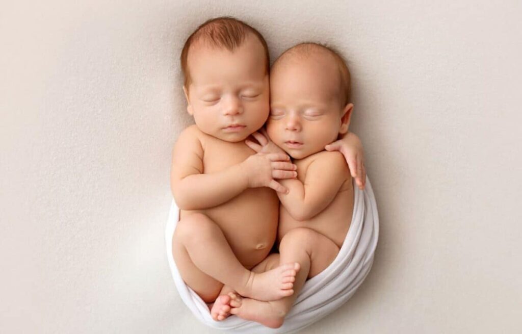 Common Complications in Twin Pregnancies and How to Prevent Them