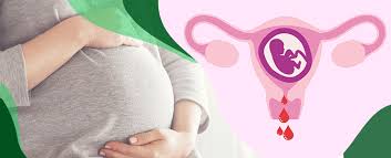 Bleeding in Early Pregnancy: What’s Normal, What’s Not